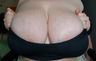 MASSIVE NATURAL MELONS